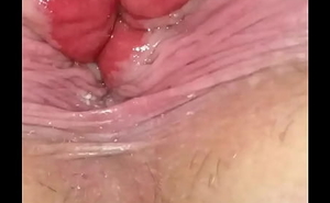 Gapping my Ass Hole near patch up together with personal